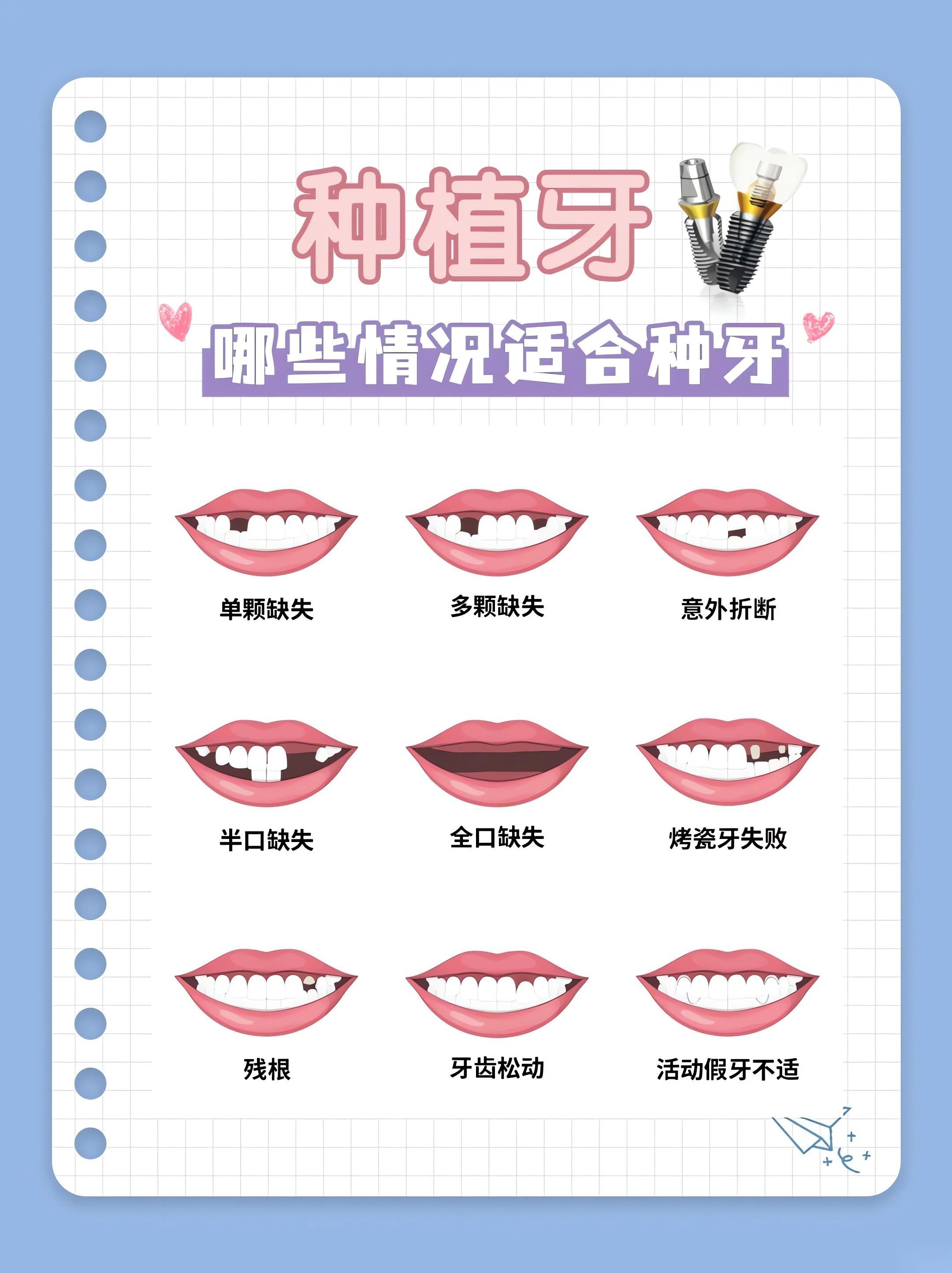 大連九諾口腔哪個(gè)大夫種植牙好？肖凱醫(yī)生經(jīng)驗(yàn)豐富技術(shù)強(qiáng)，值得信賴！ 