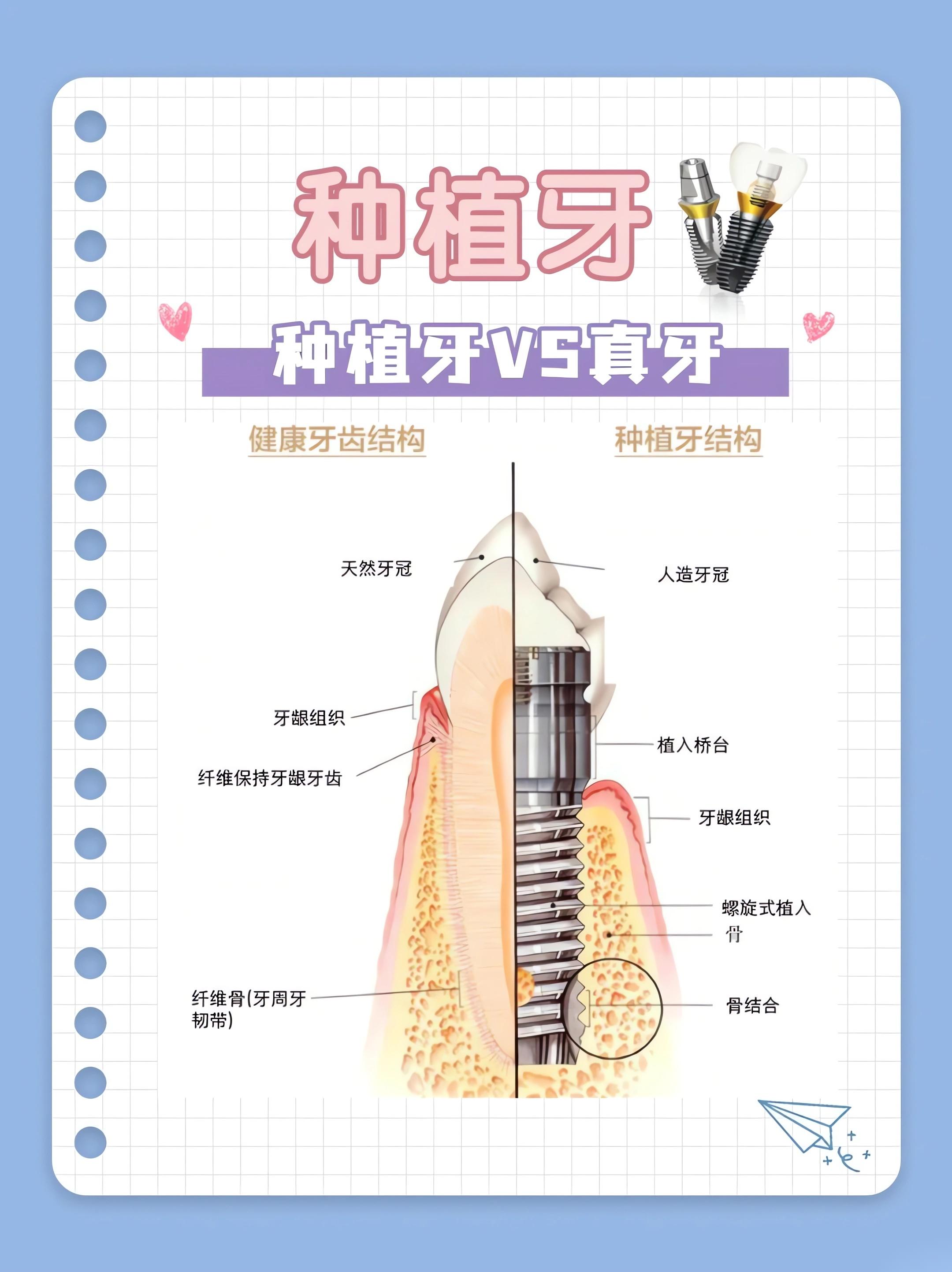 大連九諾口腔哪個大夫種植牙好？大連九諾口腔的技術(shù)實力