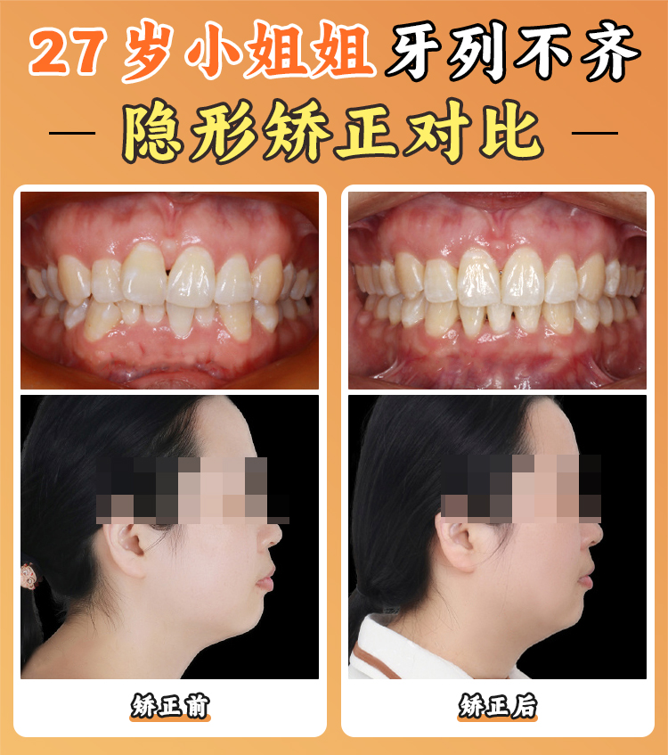 10. 長(zhǎng)沙口腔醫(yī)院集團(tuán)旗下門診部