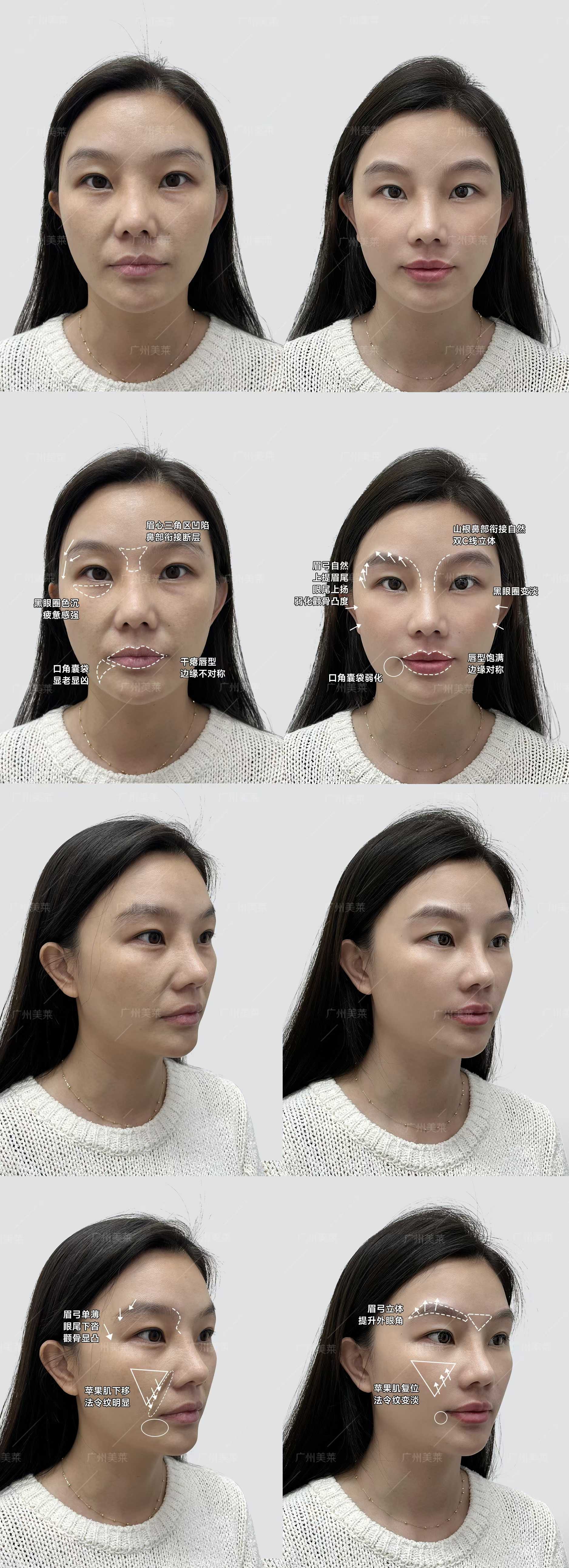 蚌埠市第一人民醫(yī)院的口碑與乘車路線www.sorencai.cn