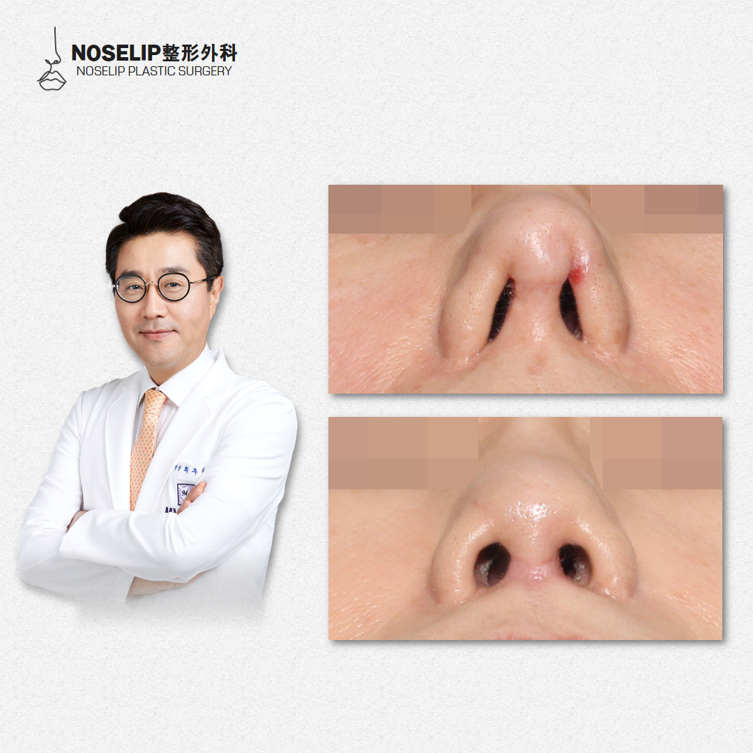 周文武醫(yī)生：精細整形的技術擔當