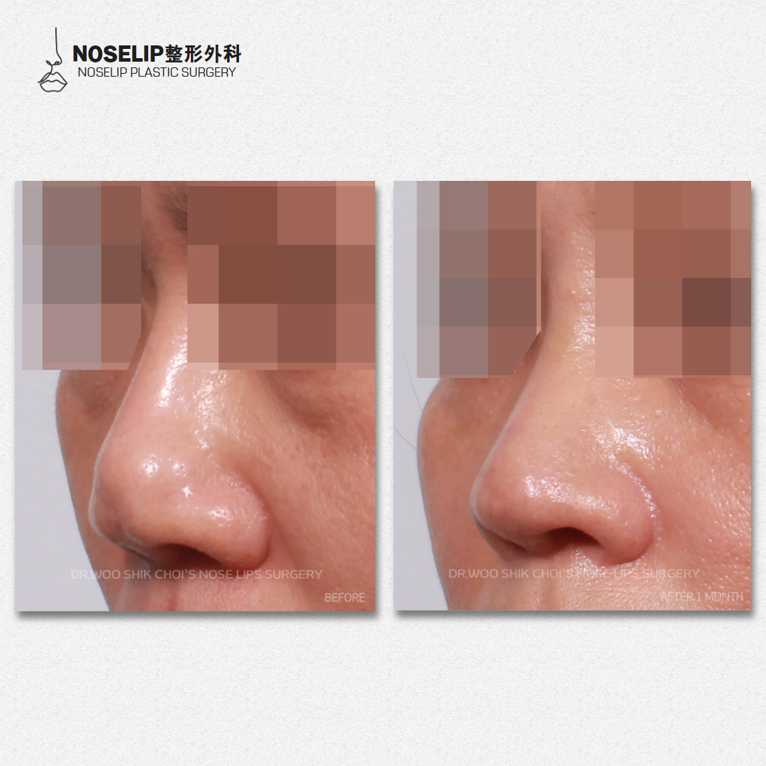 周文武醫(yī)生唇部整形靠譜嗎？他經(jīng)驗(yàn)豐富擅精細(xì)整形，口碑技術(shù)雙在線 