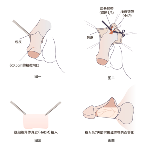 一、西安男性私密整形醫(yī)院哪家好