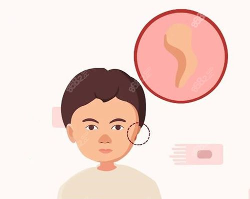 4.2 低價(jià)坑2：不用自體肋軟骨，用劣質(zhì)假體