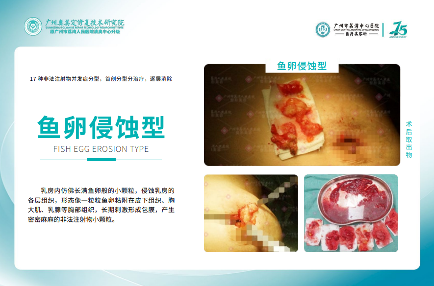 4.1 術(shù)前：精準(zhǔn)評(píng)估+個(gè)性化方案，不盲目手術(shù)