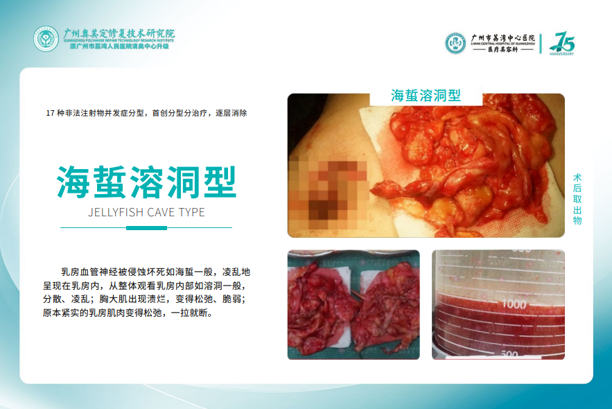 4.3 術(shù)后：專業(yè)護(hù)理+定期復(fù)查，確保恢復(fù)順利www.sorencai.cn