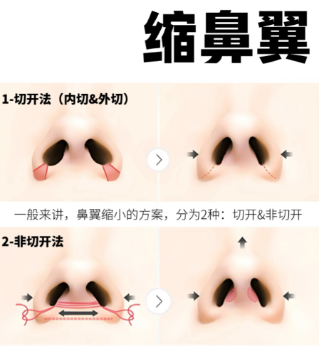 5.2 醫(yī)院設(shè)備：先進(jìn)齊全，保障手術(shù)安全