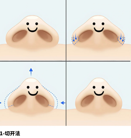 5.3 醫(yī)護(hù)團(tuán)隊：專業(yè)貼心，全程保駕護(hù)航