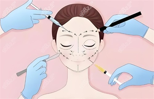 面部注射圖展示