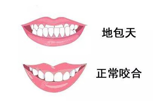 洛陽九龍口腔矯牙技術咋樣？劉春麗隱形正畸技術成熟，能模擬矯正結果