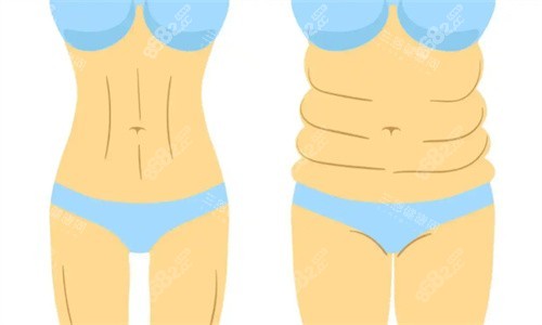 吸脂前后對比卡通圖