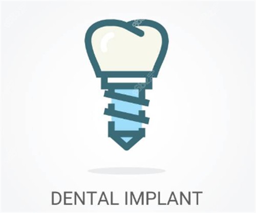 種植牙線條示意圖