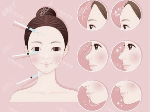 玻尿酸鼻基底填充示意圖