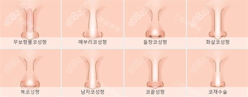 不同需要進(jìn)行鼻整形的鼻子