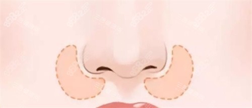 鼻基底鼻部展示圖