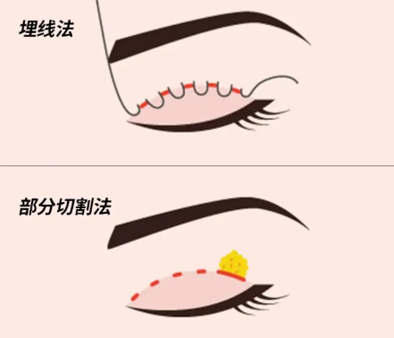 上海趙艷君醫(yī)生的情況