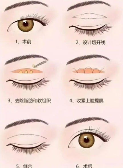 當(dāng)天面診當(dāng)天手術(shù)的可能性分析