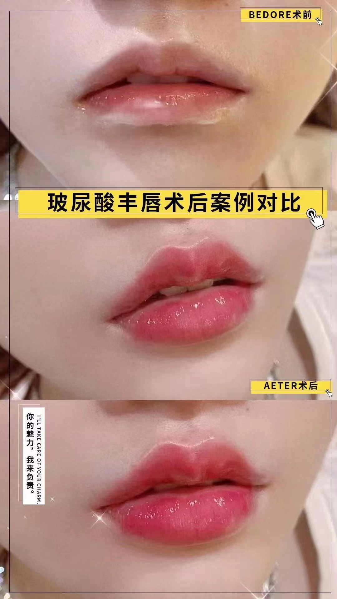 三、2026年四川華 西醫(yī)院唇腭裂修復費用明細