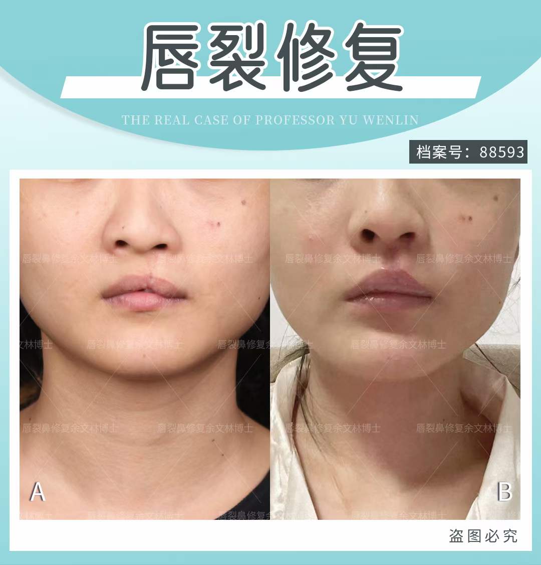 四、費用影響因素有哪些？