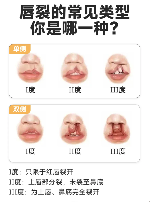 六、手術流程及注意事項www.sorencai.cn