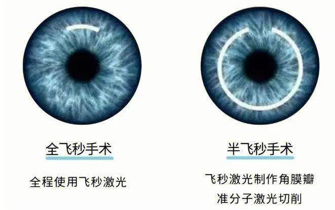 二、朝聚眼科技術特色與優(yōu)勢