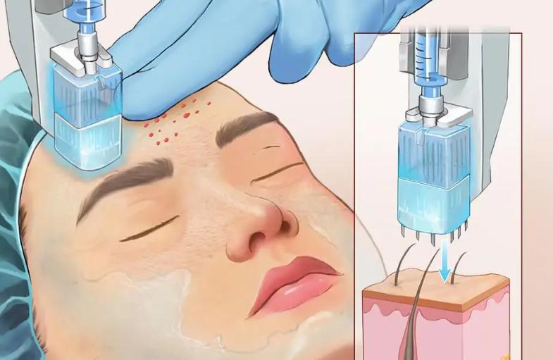 三、大連做點陣激光哪家好中設備齊全的選擇：煥貞醫(yī)美www.sorencai.cn