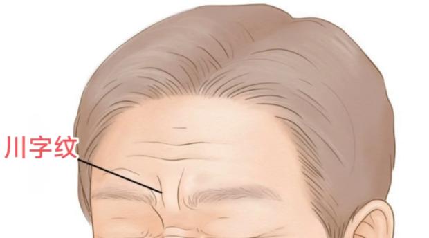 一、任冲川字纹手术有优惠吗？没有打折