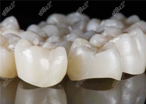 威蘭德全瓷牙圖示