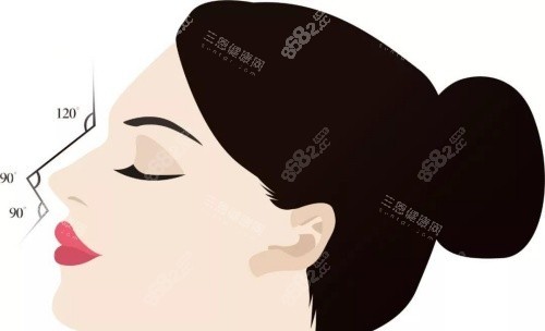 鼻整形示意圖