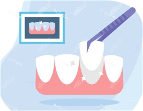 牙齒修復(fù)圖