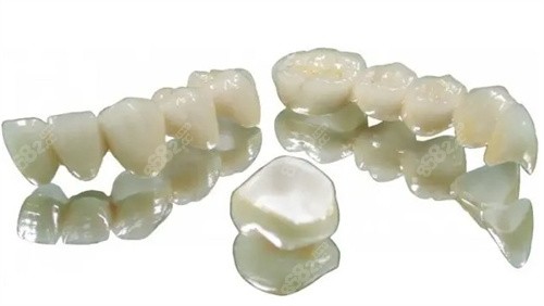 威蘭德全瓷牙冠