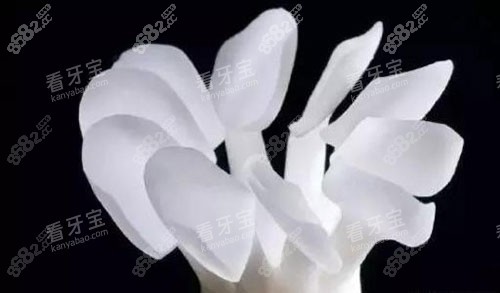 牙齒樹脂貼面示意圖