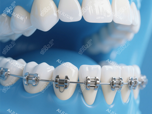 牙齒矯正示意圖