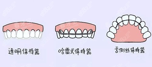 牙齒矯正正畸保持器漫畫圖