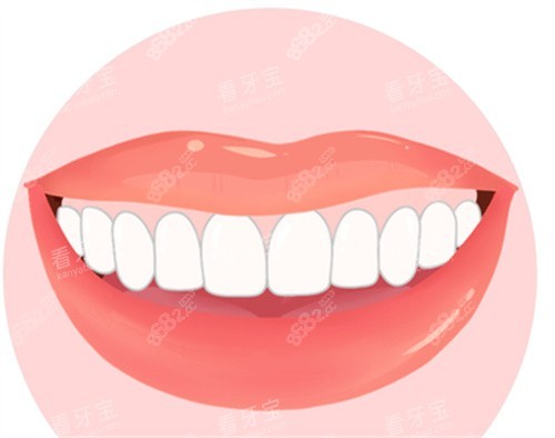 牙齒貼片圖