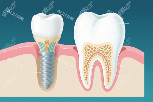 種植牙動(dòng)畫(huà)十一