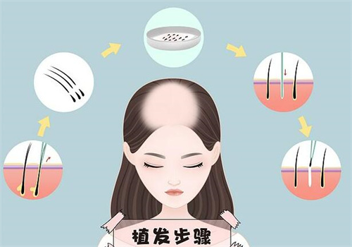 3D 紋發(fā)大概多少錢啊？不同情況價格大揭秘，看完不再懵圈！