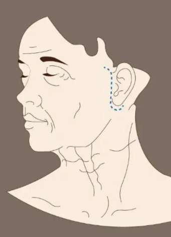 拉皮醫(yī)生溫志華坐診鄭州醫(yī)院地址