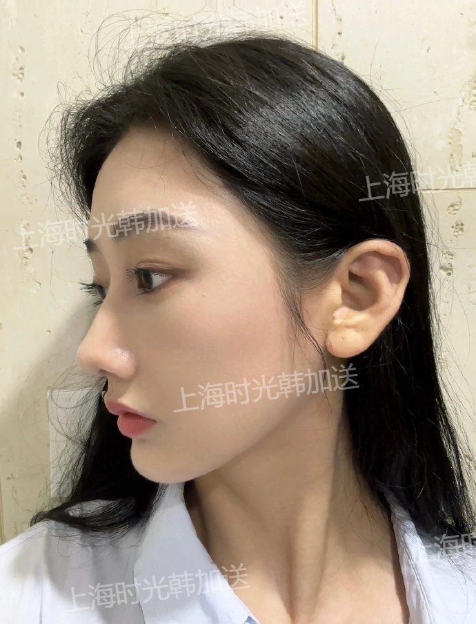 杭州做鼻子好的醫(yī)生推薦：徐利剛/李保鍇/溫科磊等十大鼻修復醫(yī)生名單奉上