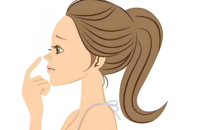 成都謝紅權(quán)醫(yī)生做鼻子效果究竟咋樣？自然風(fēng)格，真實(shí)范例來(lái)啦