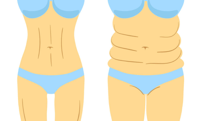 武漢包濤吸脂在哪預(yù)約｜正規(guī)渠道與流程