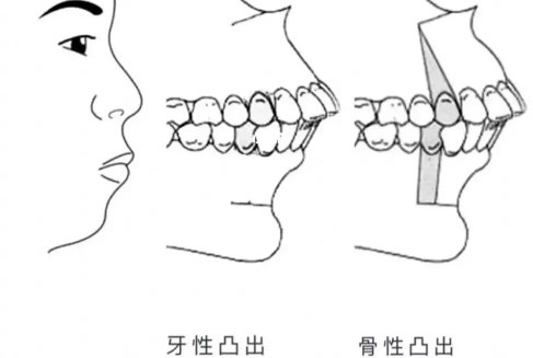 四、深圳箍牙怎么選？5個(gè)實(shí)用建議