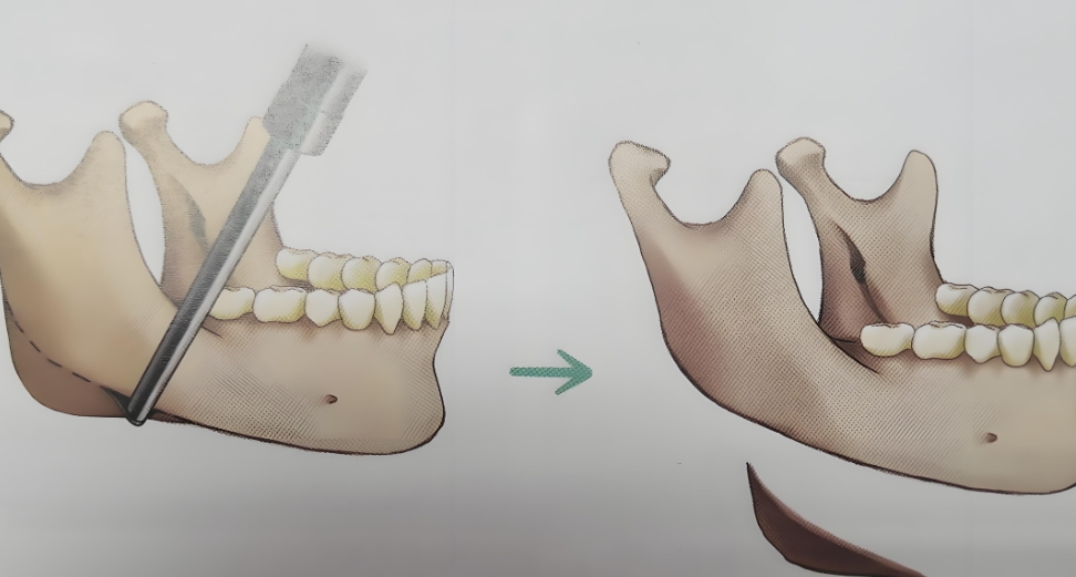 三、張笑天面診預(yù)約5-7天的核心原因（大白話拆解，不繞彎）