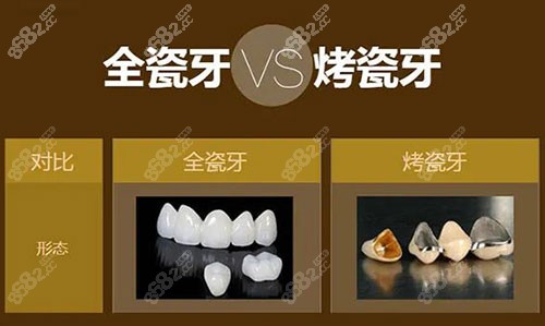 烤瓷牙和全瓷牙對比展示圖