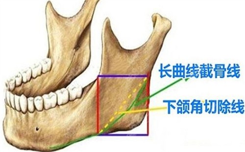 下頜角所在位置