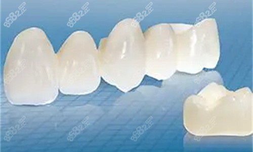 全瓷牙連橋透視圖