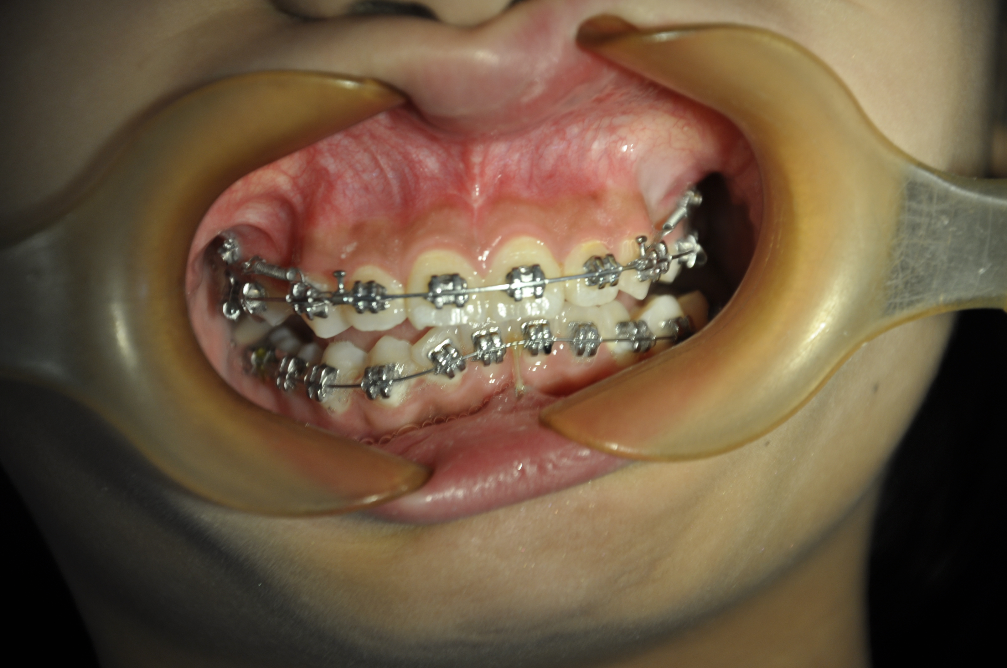 鼎秀齿科：专精团队与合理价格