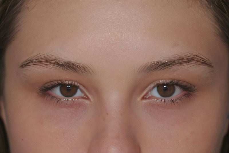 2026年沈陽四院眼科近視手術(shù)收費價目表，全飛秒9800元起，ICL晶體植入29600元，附省錢攻略