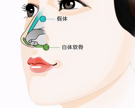 所在機(jī)構(gòu)對(duì)鐘德成醫(yī)生鼻修復(fù)技術(shù)的支持  醫(yī)院規(guī)模與實(shí)力：廈門臻醫(yī)整形醫(yī)院是廈門大型整形機(jī)構(gòu)，開展整形外科