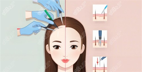 發(fā)際線 發(fā)際線